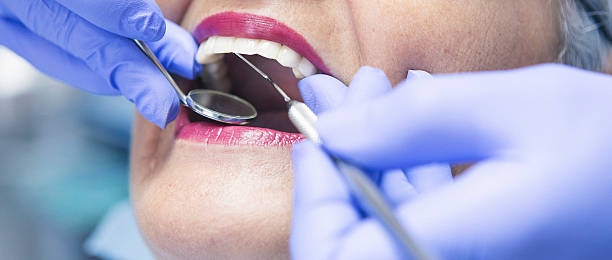 Best Emergency Dental Care for Broken or Chipped Teeth in Stanberry, MO